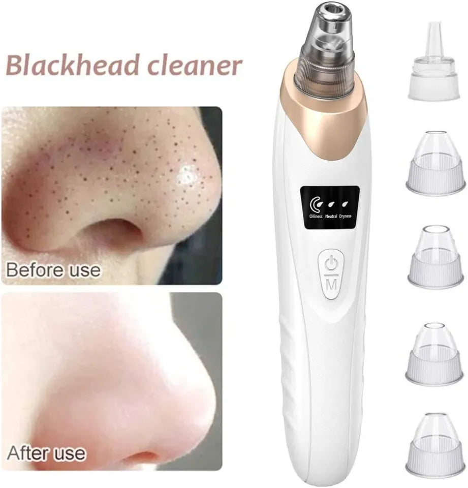 5-in-1 Blackhead Remover Machine – Rechargeable Pore Cleaner & Facial Skincare Device